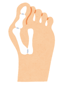 足の親指